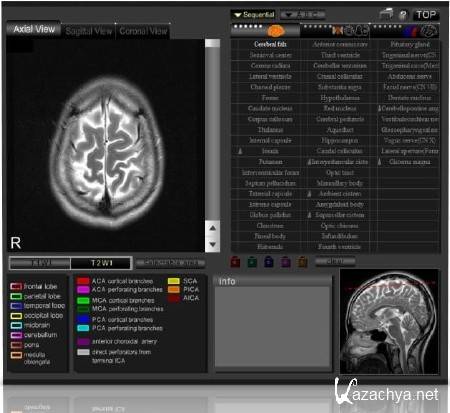 CT and MRI Interactive Atlas of Cross-Sectional Anatomy 1.1e