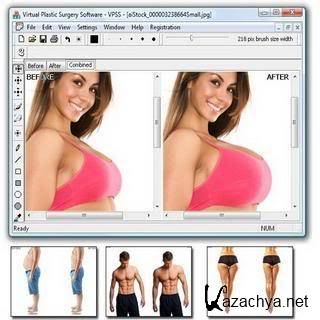 ����������� ������������ �������� / Virtual Plastic Surgery 1.2 (2010) PC