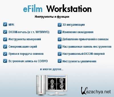 Merge eFilm Workstation 3.0 (Eng, PC) + Crack