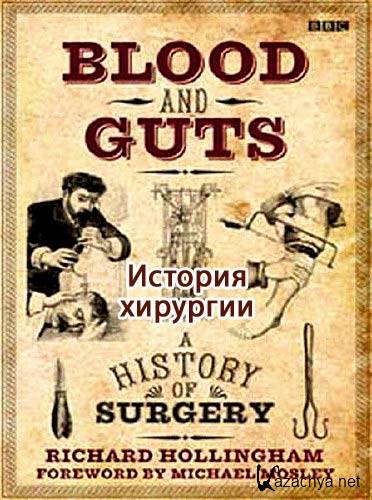 .   / Blood and Guts. A History of Surgery. Bleeding Hearts (2009)