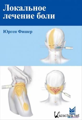 ��������� ������� ����, 3-� �������