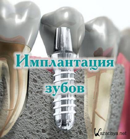 ����������� ����� (2014)