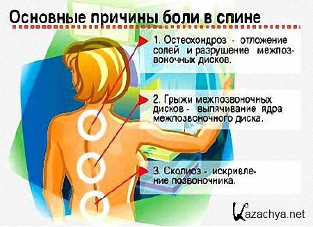 Причины болей в спине (2014) Причины болей в спине (2014)