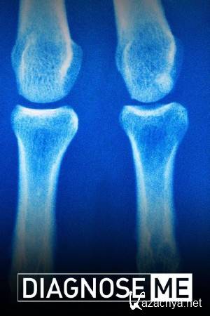 ��������� ��� �������. ������� � ������� ������ ����� / Diagnose Me (2015) HDTVRip