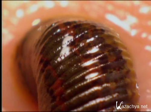 Discovery:  : ,    / Discovery: Leeches, Maggots And Bees: The Bite That Cures (2000) DVDRip